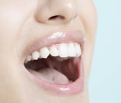 どうして歯周病になると口臭が発生するのか？
